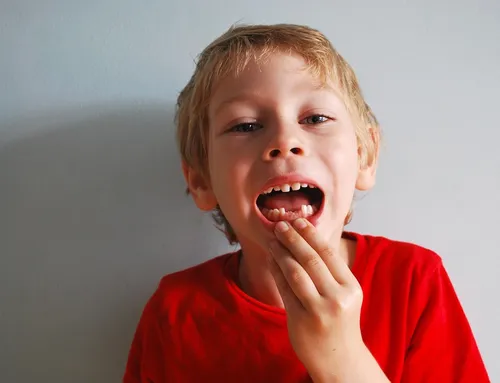 Things You Should Do After an Accidentally Knocked Off Tooth
